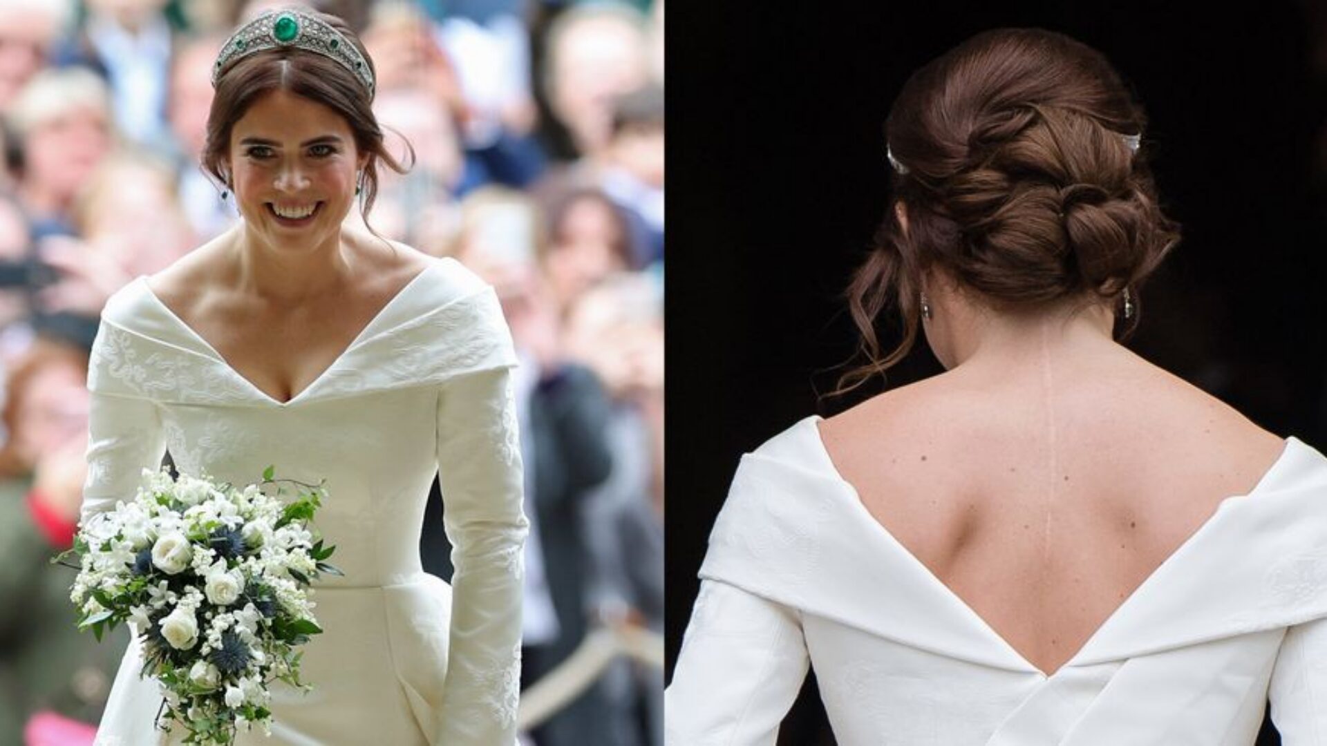 princess-eugenie-scar-1545593378